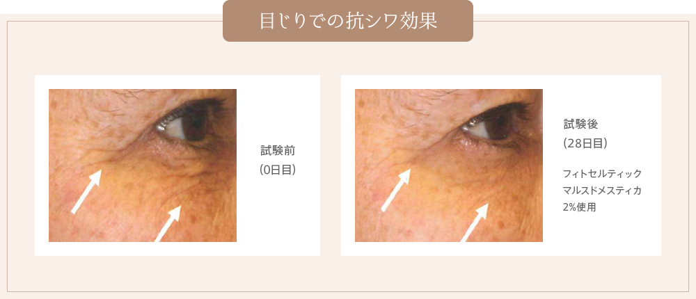 目じりでの抗シワ効果